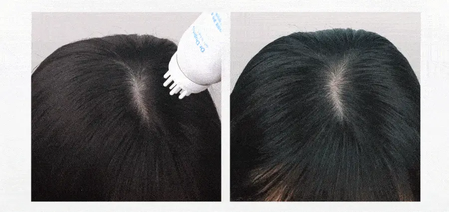 [탄산버블/두피쿨링] 하아르 닥터두피톡스 100ml 상세페이지 32